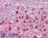 Anti-RELB Antibody IHC-plus LS-B7889