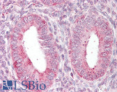 Anti-TRXR1 / TXNRD1 Antibody IHC-plus LS-B7890