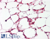 Anti-Rho Kinase / ROCK1 Antibody IHC-plus LS-B7892