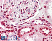 Anti-DFFB Antibody IHC-plus LS-B7893