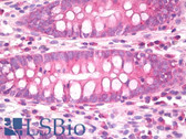 Anti-CNR1 / CB1 Antibody IHC-plus LS-B7895