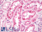Anti-RBP4 Antibody IHC-plus LS-B7898