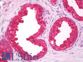 Anti-NOL3 / ARC Antibody IHC-plus LS-B7900