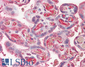 Anti-CP / Ceruloplasmin Antibody IHC-plus LS-B7911