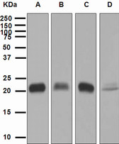 Anti-GPX1 / Glutathione Peroxidase Antibody (Internal, clone EPR3312) IHC-plus LS-B7915