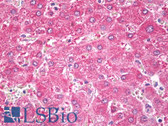 Anti-ALDH2 Antibody (Internal, clone EPR4493) IHC-plus LS-B7921