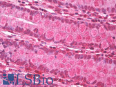 Anti-p66 / SHC Antibody (SH2 Domain, clone EP332Y) IHC-plus LS-B7922