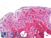 Anti-Collagen I Antibody IHC-plus LS-B7923