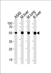 Anti-ALDH2 Antibody (Internal) IHC-plus LS-B7924