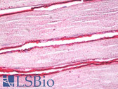 Anti-DAG1 / Dystroglycan Antibody (clone IIH6C4) IHC-plus LS-B7929
