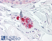 Anti-PRDX5 / Peroxiredoxin 5 Antibody IHC-plus LS-B7930
