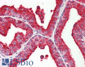 Anti-Acid Phosphatase Antibody IHC-plus LS-B7931
