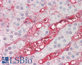 Anti-CFB / Complement Factor B Antibody IHC-plus LS-B7934