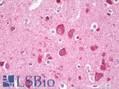 Anti-MAP1LC3A / LC3A Antibody (aa1-50) IHC-plus LS-B7938
