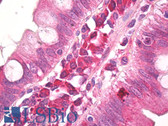 Anti-AMBRA1 Antibody (aa1-50) IHC-plus LS-B7940