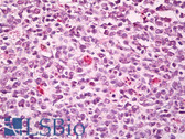 Anti-SWAP70 Antibody (aa1-50) IHC-plus LS-B7947