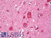 Anti-FNBP1 / FBP17 Antibody (aa30-80) IHC-plus LS-B7948