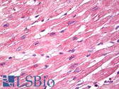 Anti-EPM2A / Laforin Antibody (aa80-130) IHC-plus LS-B7949
