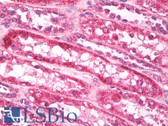 Anti-GAREM / FAM59A Antibody (aa1-50) IHC-plus LS-B7951