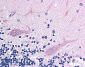 Anti-CHD4 Antibody IHC-plus LS-B204