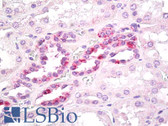 Anti-SLA Antibody (aa175-225) IHC-plus LS-B7959