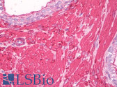 Anti-CALD1 / Caldesmon Antibody (clone l-CALD) IHC-plus LS-B7961