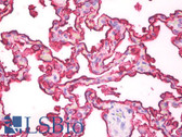 Anti-EMA / MUC1 Antibody (clone 214D4) IHC-plus LS-B7969