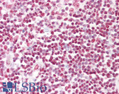 Anti-HNRNPD / AUF1 Antibody (aa49-98) IHC-plus LS-B7971