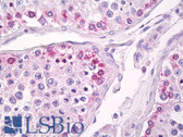 Anti-USP13 Antibody (aa500-550) IHC-plus LS-B7976