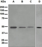 Anti-PLIN2 / ADFP / Adipophilin Antibody (Internal, clone EPR3713) IHC-plus LS-B7983