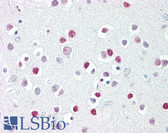 Anti-GATA4 Antibody (aa330-380) IHC-plus LS-B7989