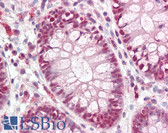 Anti-CDX2 Antibody (aa1-60) IHC-plus LS-B7990