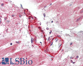 Anti-FLII / FLI Antibody (aa90-140) IHC-plus LS-B7992