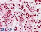 Anti-HNRNPK / hnRNP K Antibody (aa1-50) IHC-plus LS-B7994