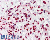 Anti-HNRNPK / hnRNP K Antibody (aa200-250) IHC-plus LS-B7995