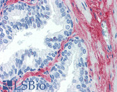 Anti-Collagen I Antibody (Biotin) IHC-plus LS-B209
