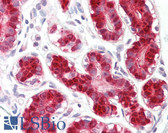 Anti-DDX58 / RIG-1 / RIG-I Antibody (aa200-250) IHC-plus LS-B8006