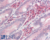 Anti-LAT Antibody (aa70-120) IHC-plus LS-B8007