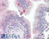 Anti-AP3M1 Antibody (aa140-190) IHC-plus LS-B8008