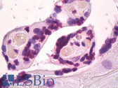 Anti-BMI1 / PCGF4 Antibody (Internal, clone EPR3745(2)) IHC-plus LS-B8010