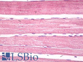 Anti-TNFRSF17 / BCMA Antibody (C-Terminus) IHC-plus LS-B8012