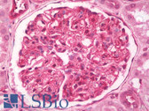 Anti-BST2 Antibody (aa1-180) IHC-plus LS-B8015