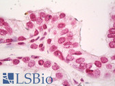 Anti-FLI1 Antibody (N-Terminus) IHC-plus LS-B8016