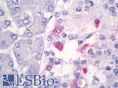 Anti-SST / Somatostatin Antibody (clone YC7) IHC-plus LS-B8018