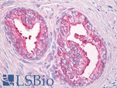 Anti-USP21 Antibody (aa466-566) IHC-plus LS-B8021
