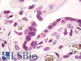 Anti-GAX / MEOX2 Antibody (Internal, clone EPR5568) IHC-plus LS-B8024