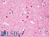 Anti-RPS6KA5 / MSK1 Antibody (aa551-600) IHC-plus LS-B8032