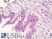 Anti-ADGRE2 / EMR2 Antibody IHC-plus LS-B8033
