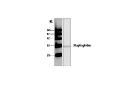 Anti-HP / Haptoglobin Antibody (aa19-406) IHC-plus LS-B8034