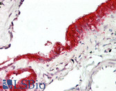 Anti-MXI1 / MAD2 Antibody (aa176-225) IHC-plus LS-B8041